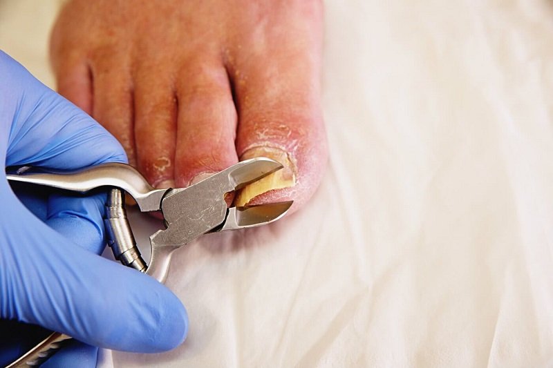 nail clippers with handles